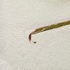 WhatsApp Image 2025-07-01 at 1.48.20 PM J-SHAPED IRRIGATING ASPIRATING CANNULA