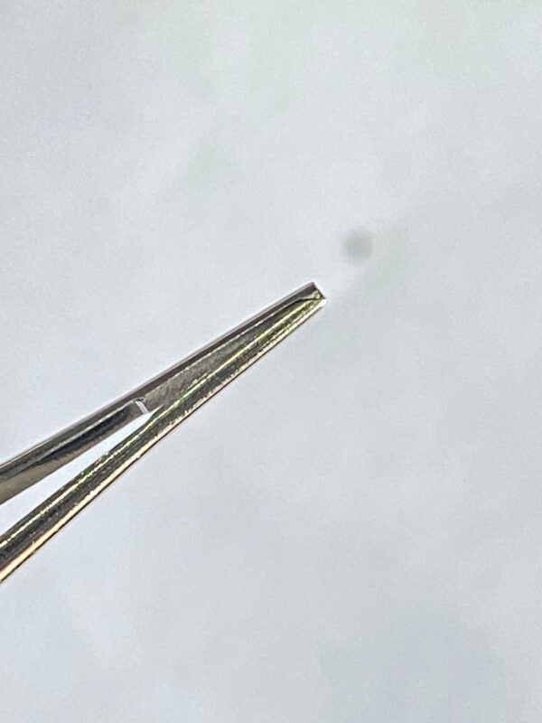 WhatsApp Image 2025-07-03 at 12.42.17 PM (2) FIXATION FORCEP TOOTH